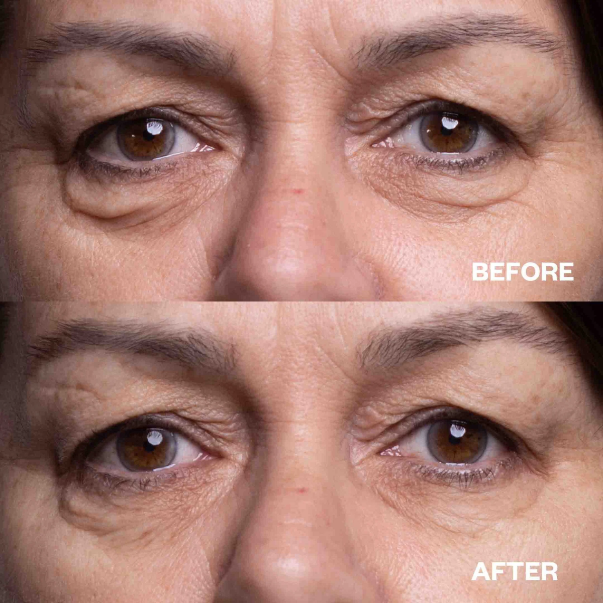 DeepCare+™ Microfusion Repair Patches
