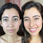 Therapy Face Mask