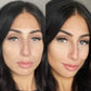 Multi-Spectral Chin & Neck Tightening Light Therapy® Device