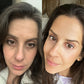 RevitaLight™ Therapy Face Mask