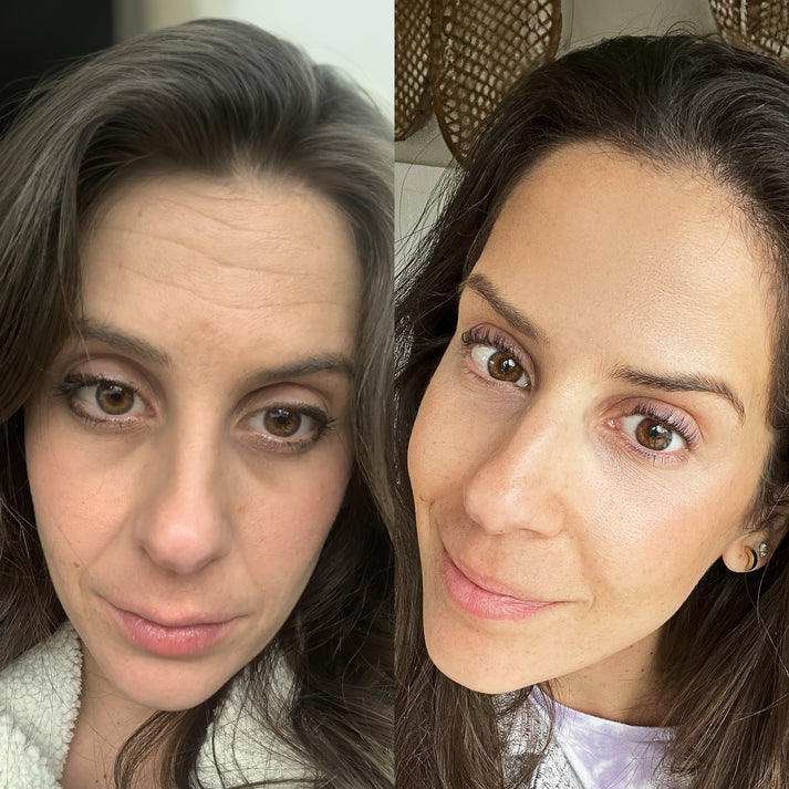 RevitaLight™ Therapy Face Mask